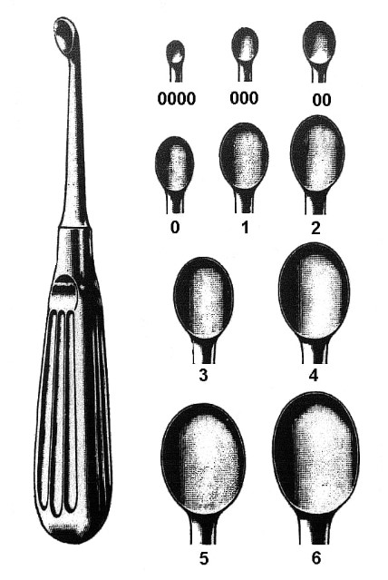 Łyżka kostna typ Volkmann 00 4mm